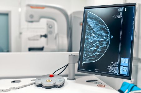 Cáncer de mama: Cómo la IA abre la puerta a detectar tumores que pasan inadvertidos en mamografías.